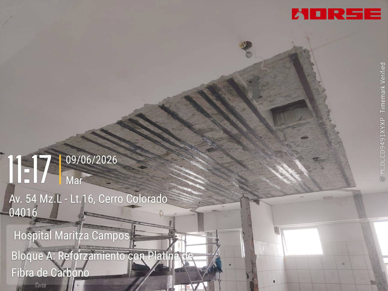 Seismic Strengthening of Hospital Slab Using CFRP Plate Seismic Strengthening of Hospital Slab Using CFRP Plate